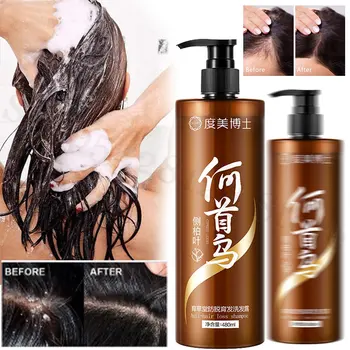 Shouwu ג ' ינסנג נגד נשירת שיער תיקון הזנה פגומים זקיקי השיער מזין את השיער נגד קשקשים-שמן שליטה שמפו לשיער